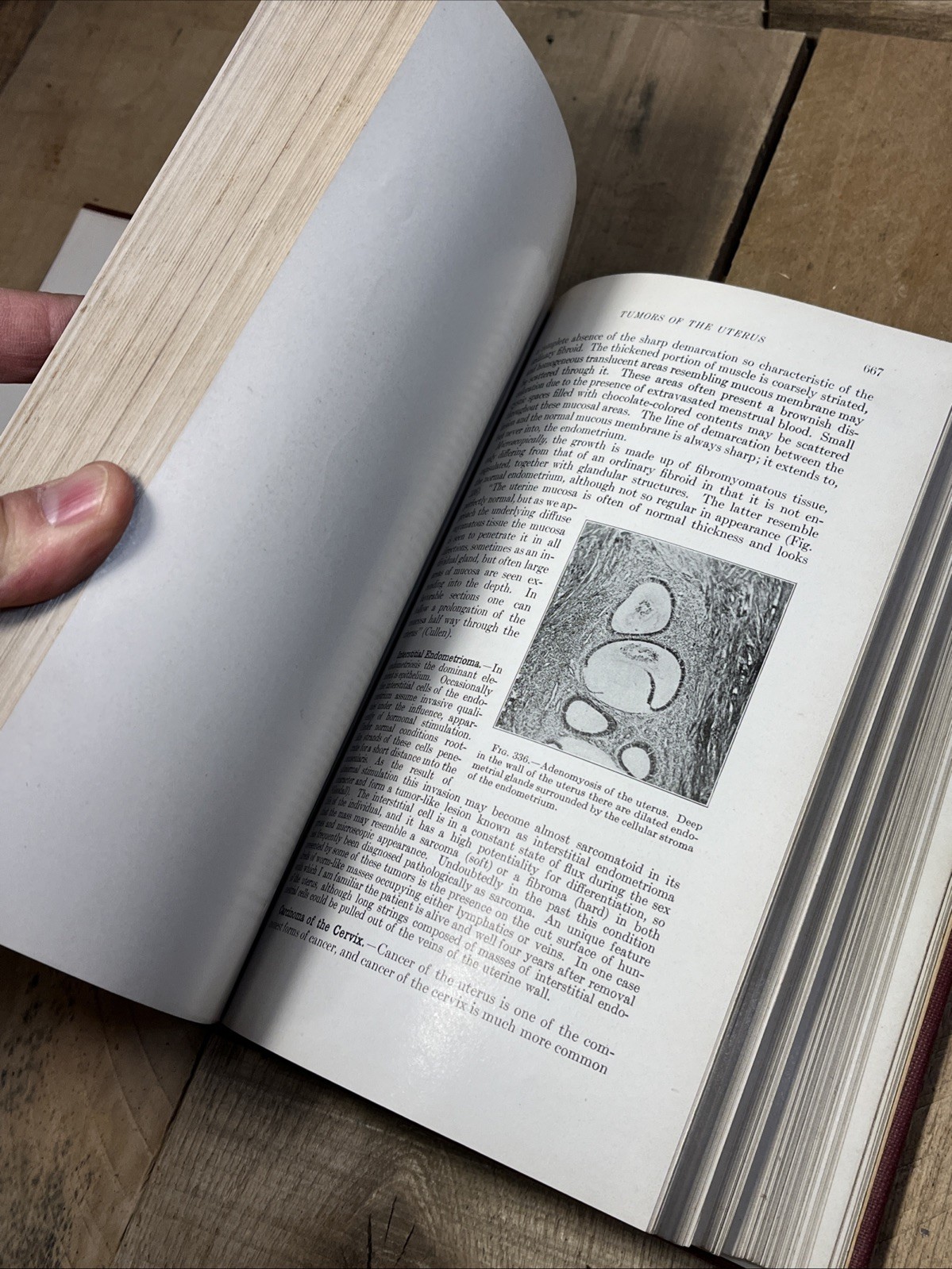 A Textbook Of Pathology by William Boyd Hardcover 1943 4th edition Fourth HBA