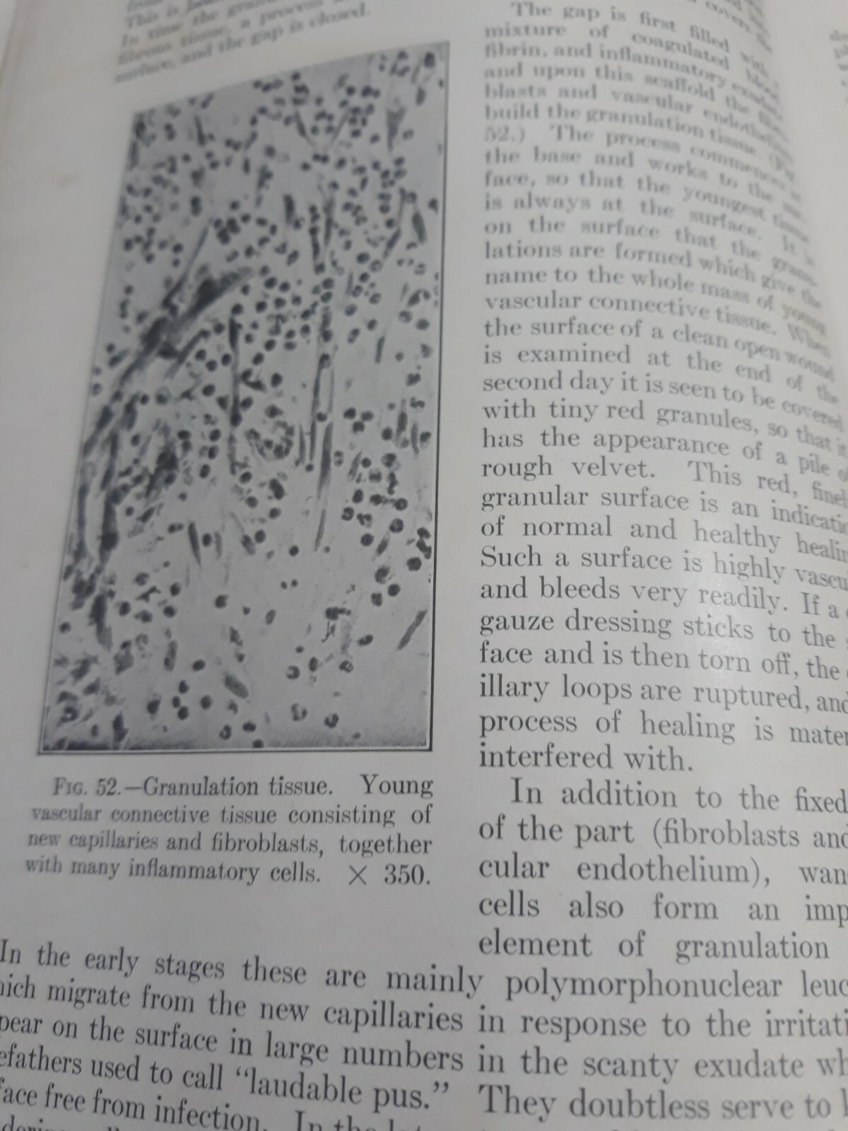 Text-Book of Pathology: SIXTH EDITION William Boyd 1953 Introduction to Medicine