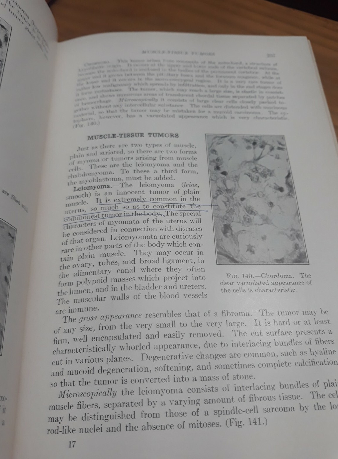 Text-Book of Pathology: SIXTH EDITION William Boyd 1953 Introduction to Medicine